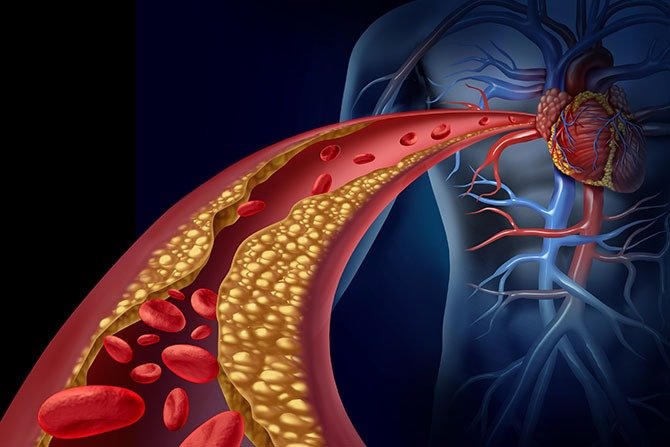 Heart Conditions Treatment in Ameerpet